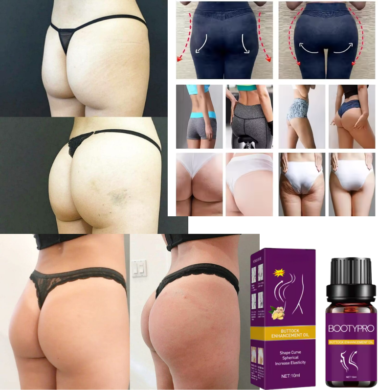 BootyUp - Aceite Aumentador de Glúteos Premium | Levanta, Tonifica y Esculpe